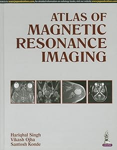 Atlas of Magnetic Resonance Imaging by M.D. Singh, Hariqbal