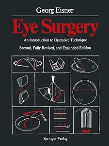Eye Surgery: An Introduction to Operative Technique by Georg C. Eisner
