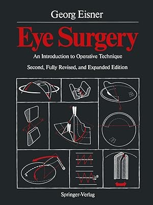 Eye Surgery: An Introduction to Operative Technique