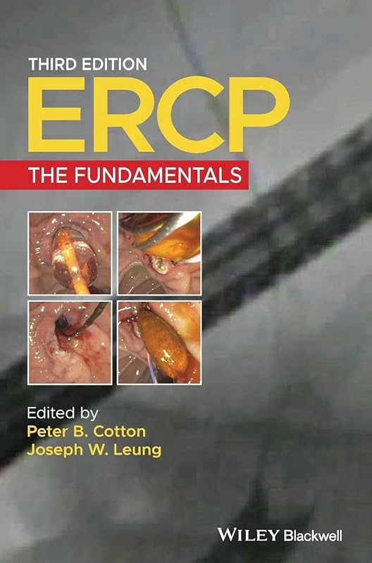 ERCP: The Fundamentals by Peter B. Cotton