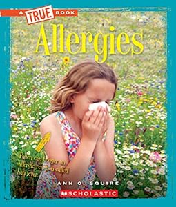 Allergies