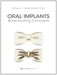 Oral Implants: Bioactivating Concepts by Rolf Ewers