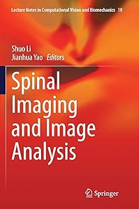 Spinal Imaging and Image Analysis (Lecture Notes in Computational Vision and Biomechanics, 18) by Shuo Li