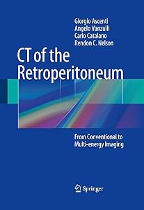 CT of the Retroperitoneum: From Conventional to Multi-energy Imaging by Giorgio Ascenti