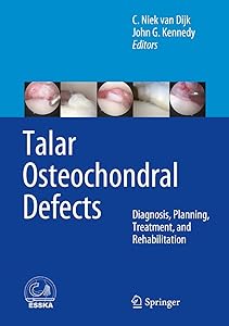 Talar Osteochondral Defects: Diagnosis, Planning, Treatment, and Rehabilitation by C. Niek van Dijk