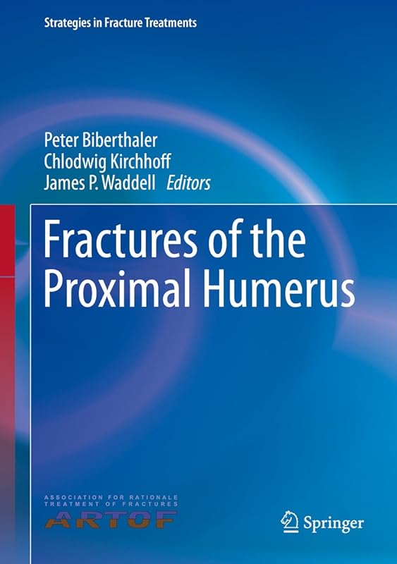 Fractures of the Proximal Humerus (Strategies in Fracture Treatments) by Peter Biberthaler