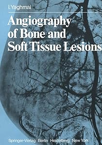 Angiography of Bone and Soft Tissue Lesions by I. Yaghmai