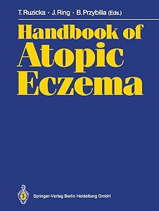 Handbook of Atopic Eczema by Thomas Ruzicka