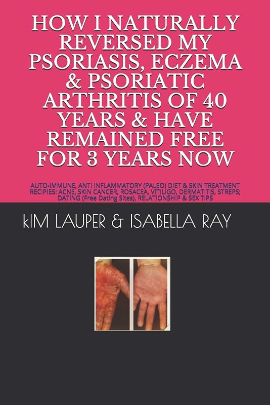 HOW I NATURALLY REVERSED MY PSORIASIS, ECZEMA AND PSORIATIC ARTHRITIS OF 40 YEARS AND HAVE REMAINED FREE FOR 3 YEARS NOW: AUTO IMMUNE, GLUTEN FREE, ... RELATIONSHIP (Free Dating Sites) & SEX TIPS by Kim Lauper