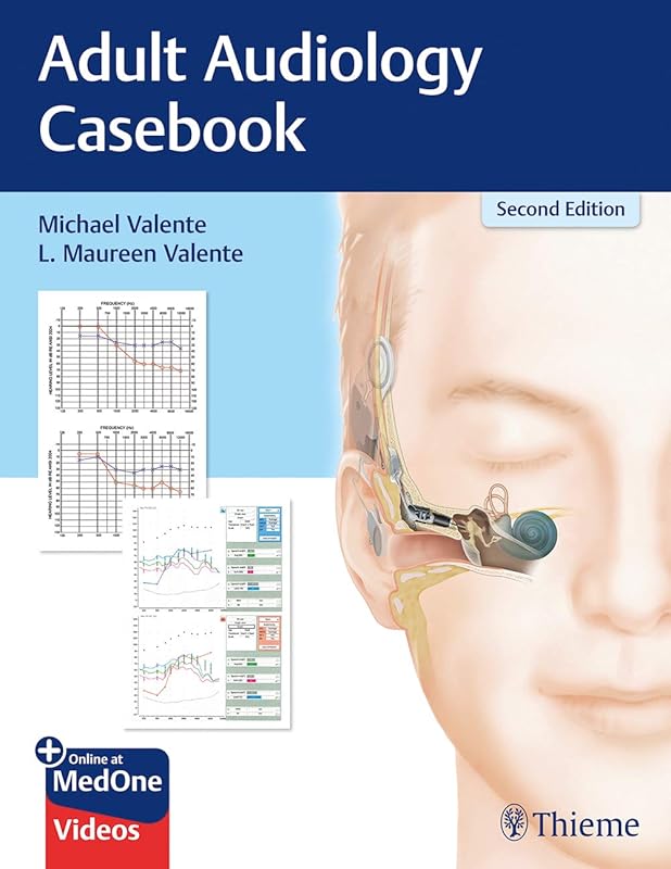 Adult Audiology Casebook by Michael Valente