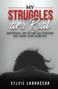 My Struggles are Real: Showing my scars so others know they can survive by Sylvie Ladouceur
