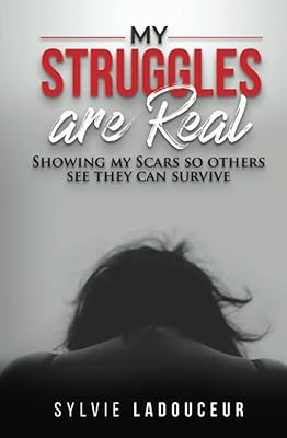 My Struggles are Real: Showing my scars so others know they can survive