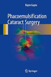 Phacoemulsification Cataract Surgery by Rajen Gupta