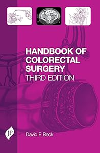 Handbook of Colorectal Surgery: Third Edition by David Beck