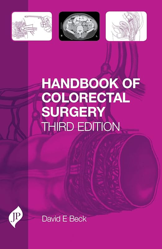 Handbook of Colorectal Surgery: Third Edition by David Beck