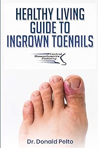 The Healthy Living Guide to Ingrown Toenails by Dr. Donald Pelto