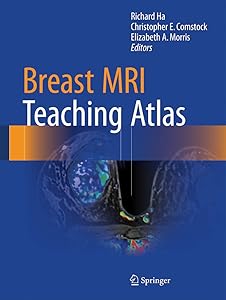Breast MRI Teaching Atlas