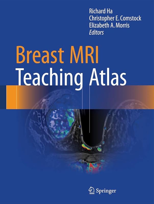 Breast MRI Teaching Atlas by Richard Ha