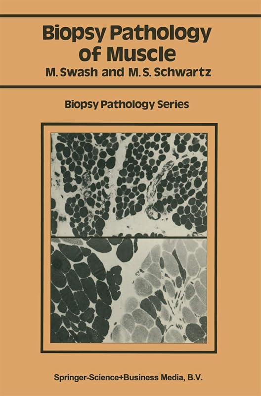 Biopsy pathology of muscle (Biopsy Pathology Series) by Michael Swash
