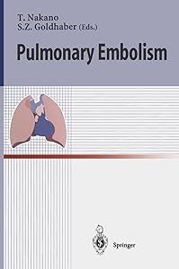 Pulmonary Embolism by Takeshi Nakano