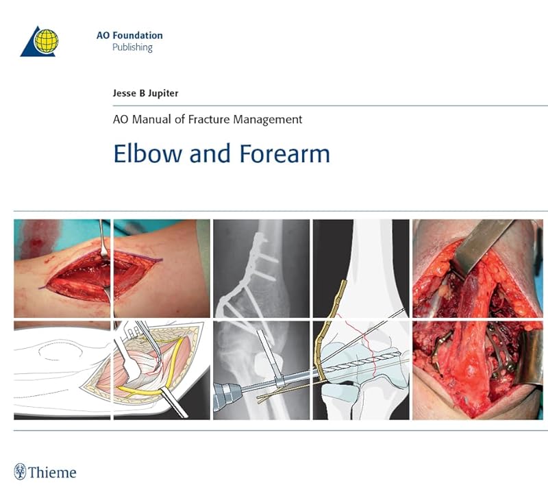 AO Manual of Fracture Management - Elbow and Forearm (AO-Publishing) by Jesse Jupiter