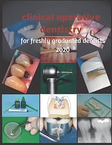 clinical operative dentistry for freshly graduated dentists 2020: dental restorative procedures: clinical conservative dentistry by Mostafa Ali