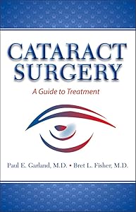 Cataract Surgery: A Guide to Treatment by Bret L Fisher