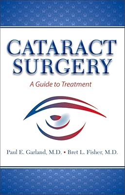 Cataract Surgery: A Guide to Treatment