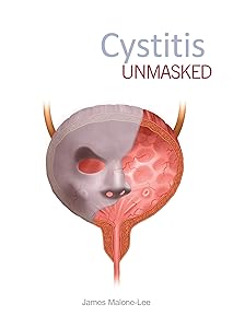 Cystitis Unmasked by Professor James Malone-Lee MD FRCP