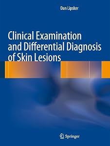Clinical Examination and Differential Diagnosis of Skin Lesions by Dan Lipsker
