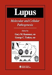 Lupus: Molecular and Cellular Pathogenesis (Contemporary Immunology) by Gary M. Kammer
