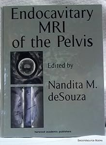 Endocavitary MRI of the Pelvis by Nandita M. deSouza