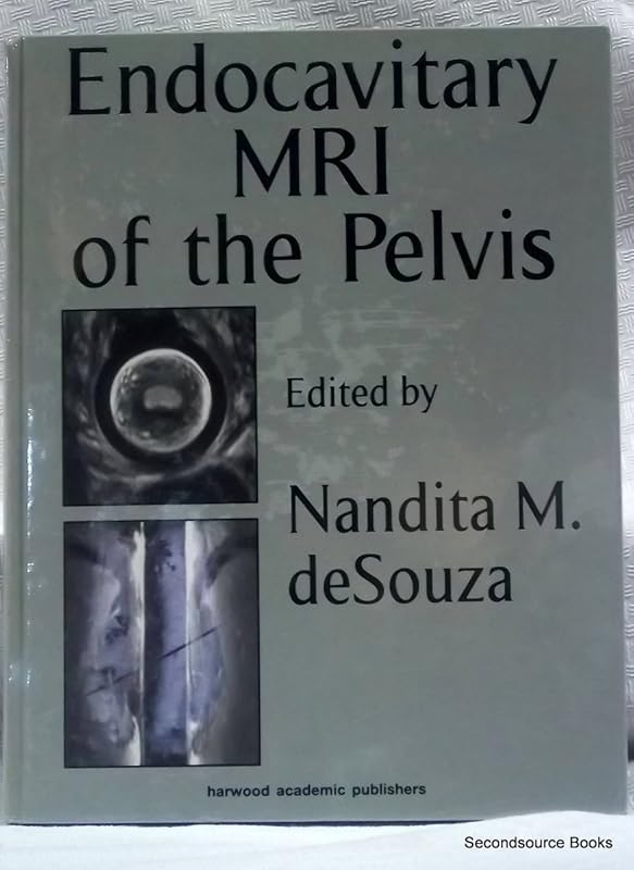 Endocavitary MRI of the Pelvis by Nandita M. deSouza