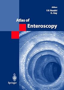 Atlas of Enteroscopy by F.P. Rossini