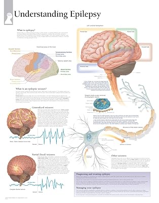 Understanding Epilepsy chart: Laminated Wall Chart