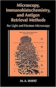 Microscopy, Immunohistochemistry, and Antigen Retrieval Methods: For Light and Electron Microscopy
