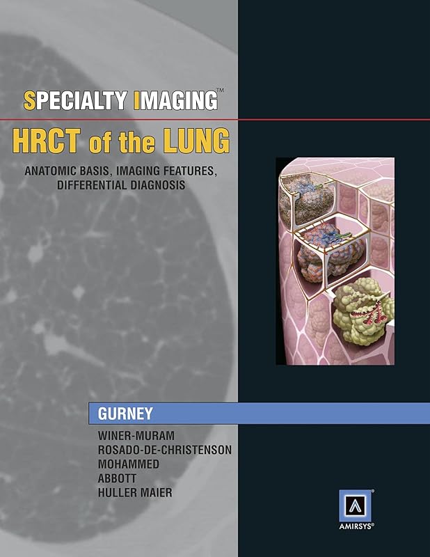 Specialty Imaging: HRCT of the Lung, Anatomic Basis, Imaging Features, Differential Diagnosis by Jud W. Gurney