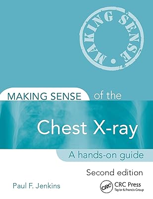 Making Sense of the Chest X-ray: A hands-on guide
