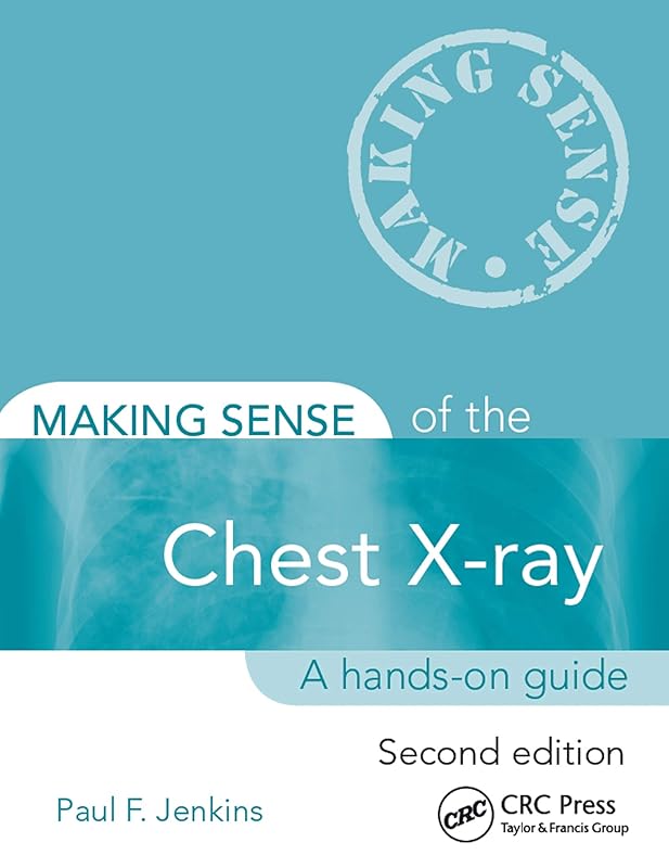 Making Sense of the Chest X-ray: A hands-on guide by Paul Jenkins