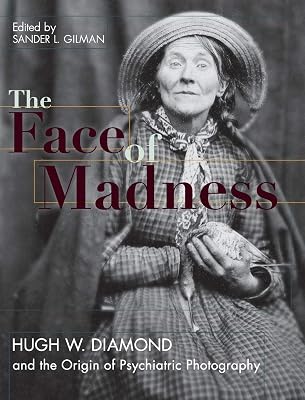 Face of Madness: Hugh W. Diamond and the Origin of Psychiatric Photography