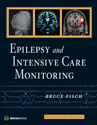 Epilepsy and Intensive Care Monitoring: Principles and Practice