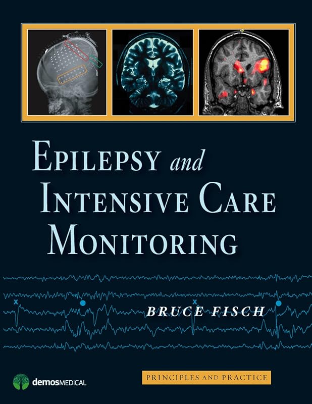 Epilepsy and Intensive Care Monitoring: Principles and Practice by Bruce Fisch MD