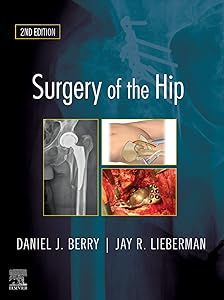 Surgery of the Hip: Expert Consult - Online and Print by Daniel J. Berry