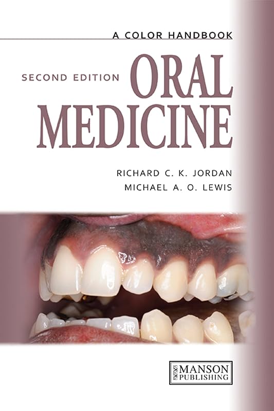 Oral Medicine (Medical Color Handbook Series) by Michael Lewis