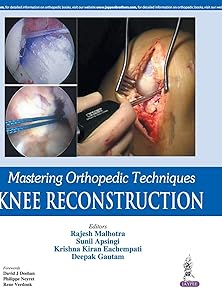 Mastering Orthopedic Techniques: Knee Reconstruction by Ramesh Malhotra