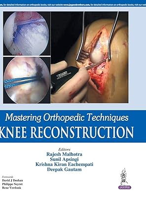 Mastering Orthopedic Techniques: Knee Reconstruction