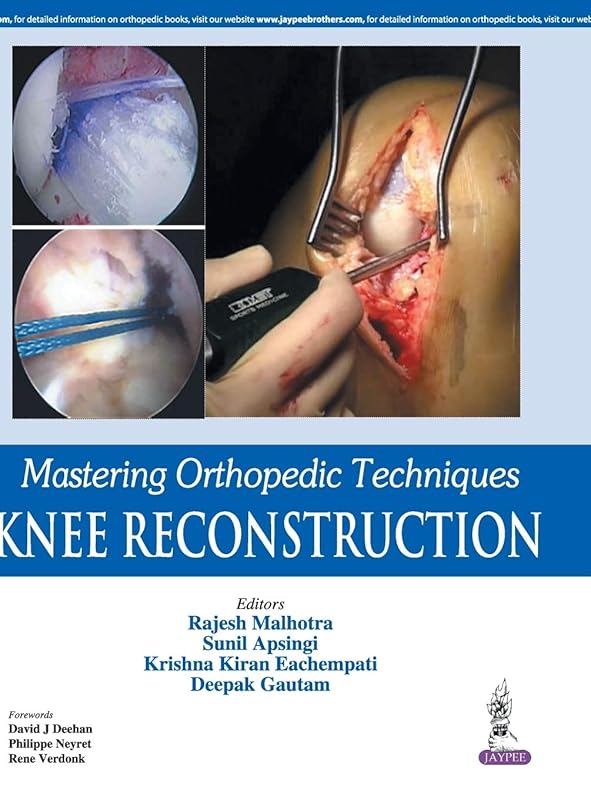 Mastering Orthopedic Techniques: Knee Reconstruction by Ramesh Malhotra