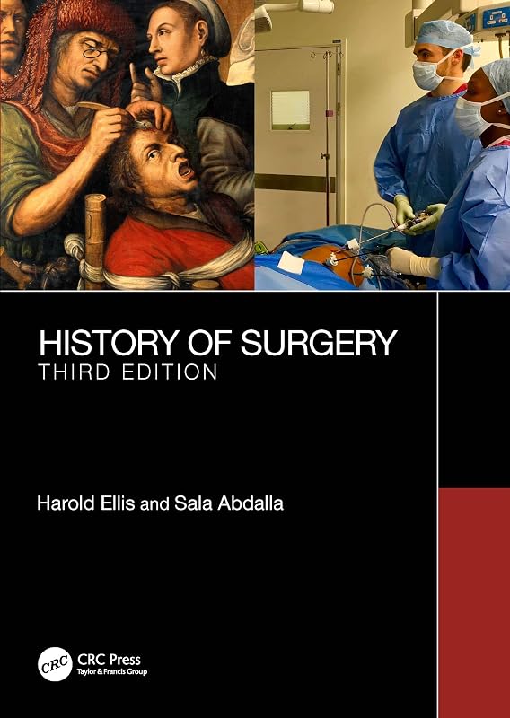 A History of Surgery: Third Edition by Harold Ellis