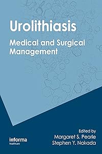 Urolithiasis: Medical and Surgical Management of Stone Disease by Margaret S. Pearle