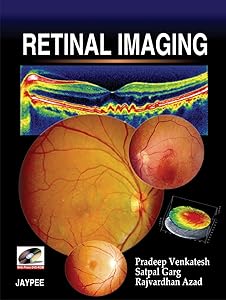 Retinal Imaging by Pradeep Venkatesh